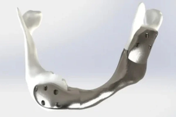 Medical Titanium Rods Medical Titanium Rods